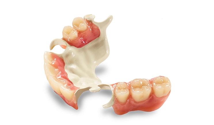removable-dentures