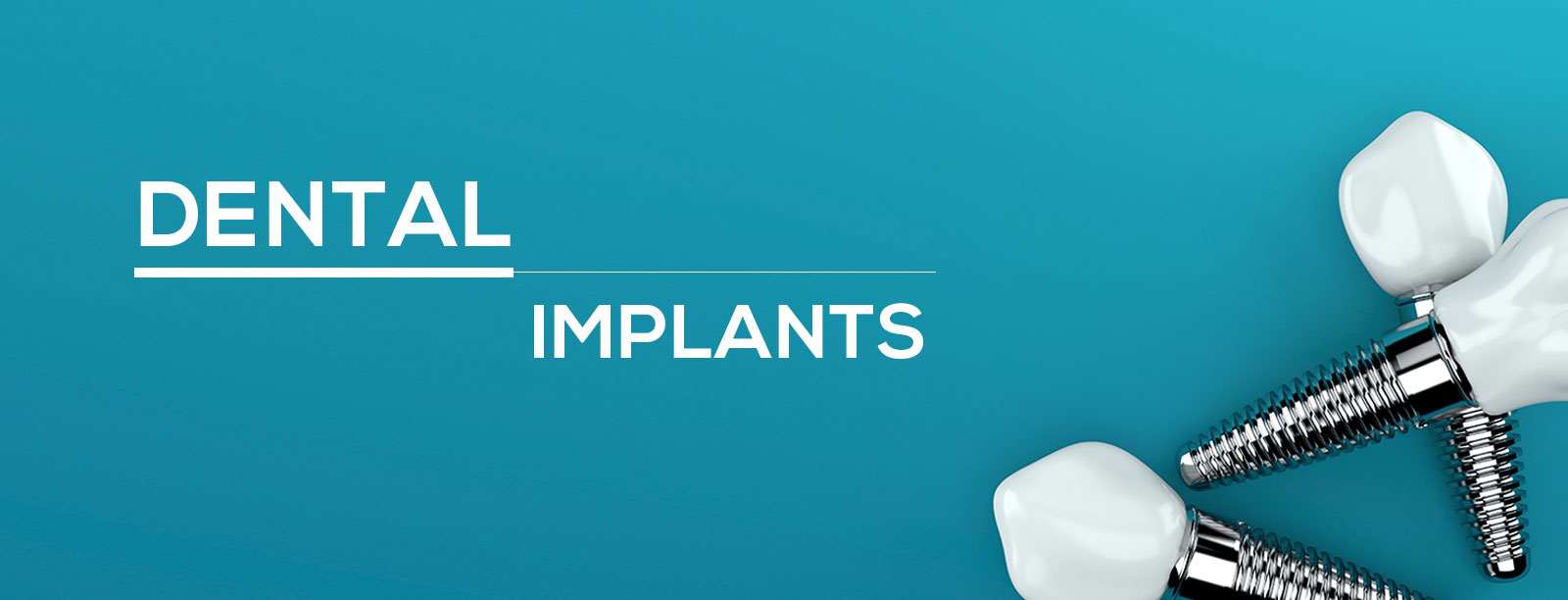 dental implants in chennai, tamil nadu, india