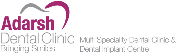 adarsh dental clinic dental implant centre chennai